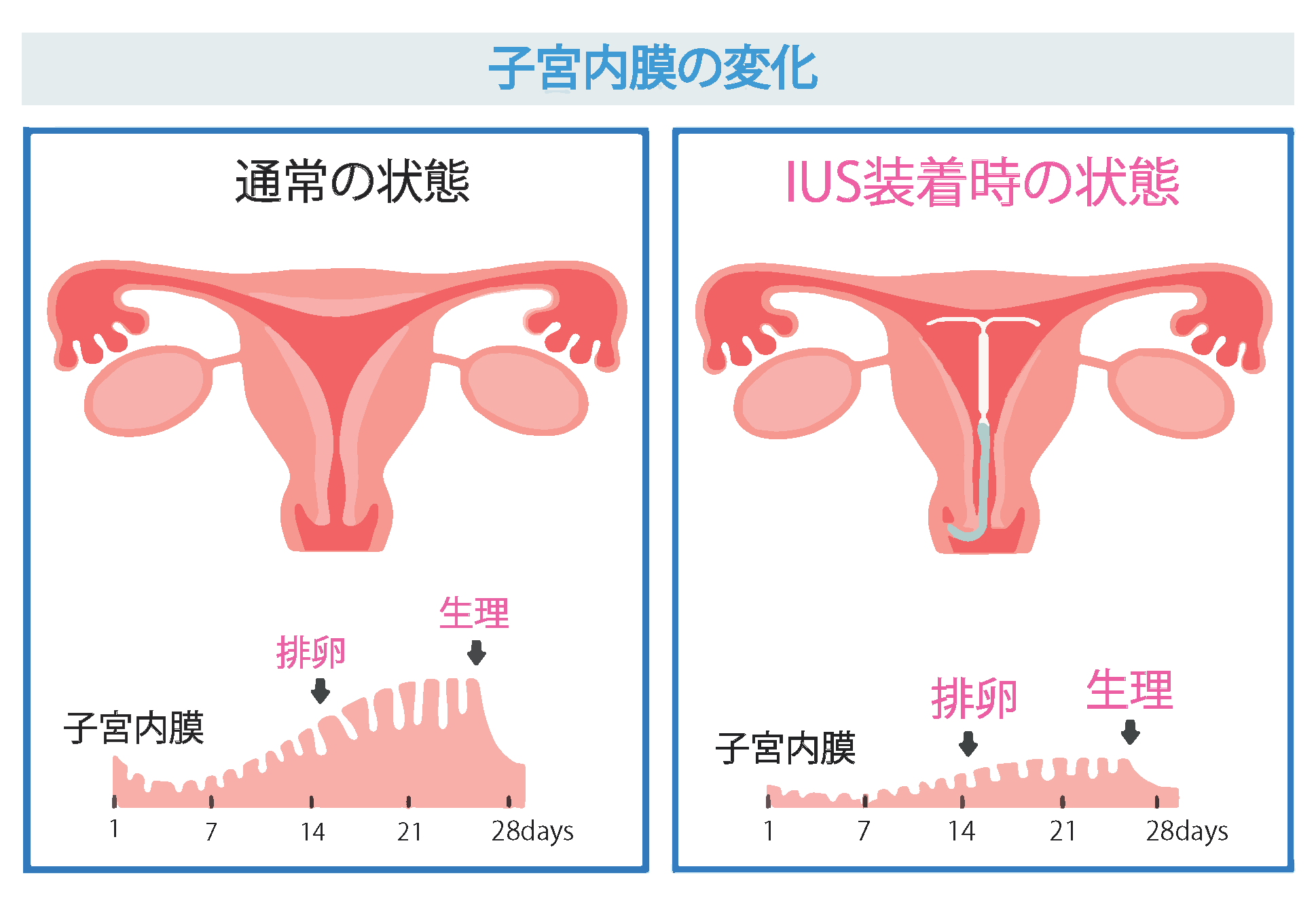子宮内膜の変化